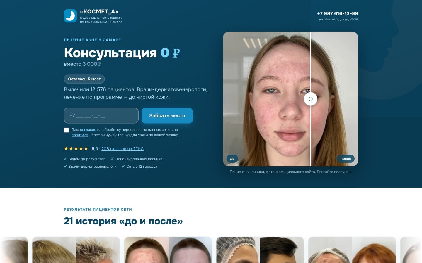 kosmet-a.ru: лечение акне в Самаре, консультация 0 ₽